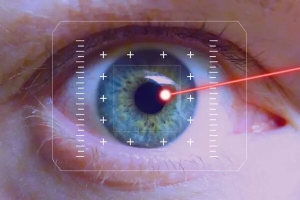 Retinal Laser